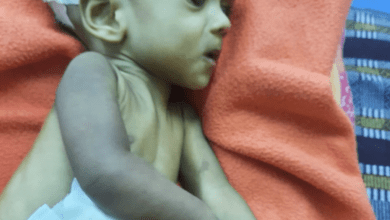 www.theindiaprint.com tamil nadu baby loses an arm parents accuse doctor of medical negligence political conflict emerges toddlers hand amputated one one 11zon