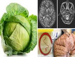 theindiaprint.com experts warn about possible risks associated with cabbage download 2023 11 24t0953