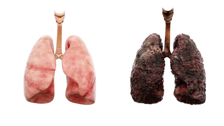 theindiaprint.com how well maintained are smokers lungs healthy lung damaged lung lung cancer fa84b1