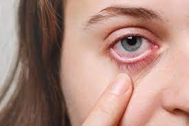 theindiaprint.com if untreated bloodshot eyes might become a silent killer illness download 2023 11