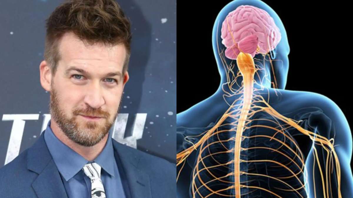 Actor Kenneth Mitchell of “Captain Marvel” passes away from ALS; learn everything there is to know about this deadly neurological condition